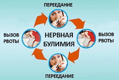 Лечение булимии в Вельске